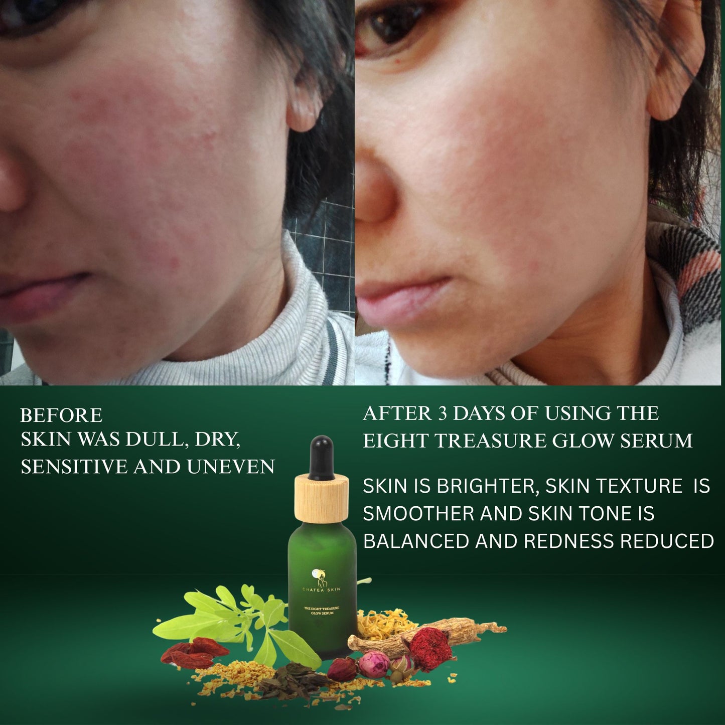 The Eight Treasure™ Glow Serum 30ml