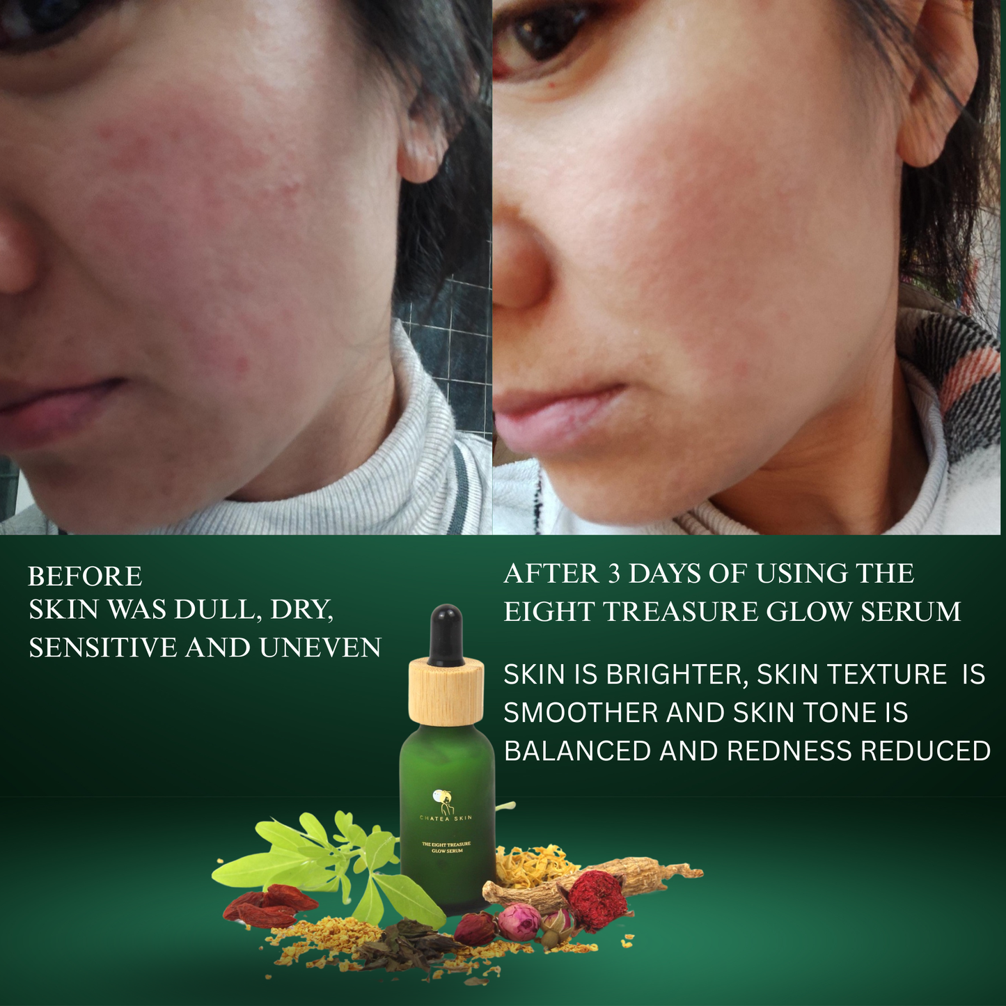 The Eight Treasure™ Glow Serum 10ml